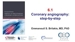 61 Manual of PCI  How to perform coronary angiography [upl. by Sille]