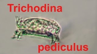 trichodina pediculus [upl. by Earazed]