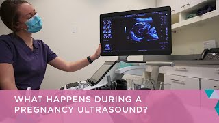 What happens during a pregnancy ultrasound [upl. by Justinian]