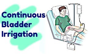 Continuous Bladder Irrigation  RN Krizzy [upl. by Parnas173]