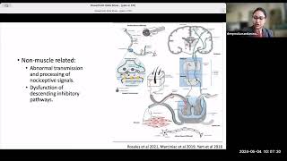 Deepmala Nandanwar MD  Pain with Cervical Dystonia [upl. by Osbert]