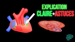 🔴 EXPLICATION CLAIRE ET ASTUCES POUR LES VALVES CARDIAQUES  DR ASTUCE [upl. by Tiana]