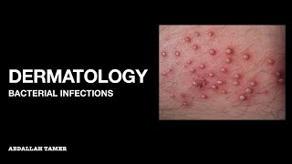 BACTERIAL SKIN INFECTIONS  QUICK REVIEW بالعربي [upl. by Sekyere374]