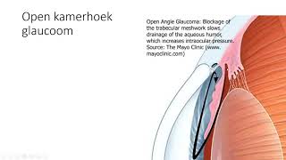glaucoom [upl. by Eiramnaej]