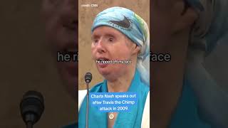 Charla Nash speaks out after Travis the Chimp attack in 2009 shorts [upl. by Yelnoc97]