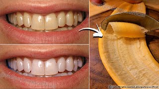 Secret that Dentists dont want you to know Remove Tartar and Teeth Whitening in just 2 minutes🪥🦷 [upl. by Devonna]