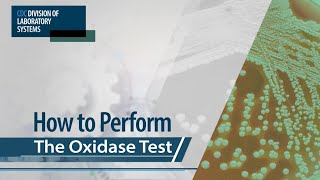 How to Perform the Oxidase Test [upl. by Gollin726]