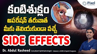 Side effects after cataract surgery  కంటి శుక్లాల సర్జరీ  Cataract surgery  Dr Abdul Rasheed [upl. by Glenden122]