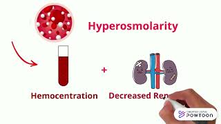 8 Hemoconcentration [upl. by Nasya977]