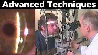 Slit Lamp Specular Reflection  Retroillumination  Sclerotic Scatter and more Advanced Techniques [upl. by Capwell]