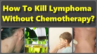 How To Kill Lymphoma Without Chemotherapy But With The Natural Remedies [upl. by Letch]