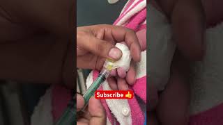 Iv cannula technique in newborn trending viralvideo care shorts [upl. by Llerdna]