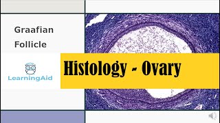 Ovarian Follicles  Histology made easy [upl. by Corenda]