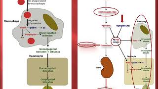 ANEMIES HEMOLYTIQUES EN PEDIATRIE [upl. by Aiello]