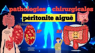 cours S3  Pathologies Chirurgicales et SI  Péritonite aigue 💊🩺💉🩸 شرح سهل 📚و 📚 مبسط للفهم [upl. by Elvera]