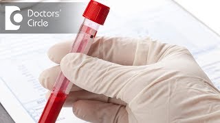 What are the most common blood tests done in Biochemistry  Dr Samit Thakur [upl. by Atirhs800]