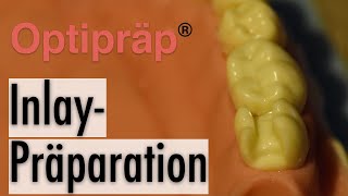 Inlaypräparation mit Optipräp®Instrumenten [upl. by Abate]