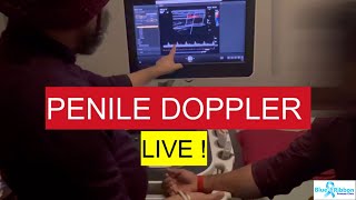 penile doppler kaise karte hain  live TEST demo in Delhi in hindi [upl. by Adabelle]