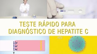 Teste Rápidos para diagnóstico da Hepatite C [upl. by Jerz]