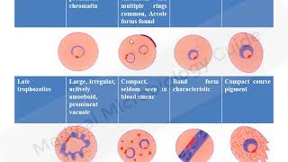 Laboratory diagnosis of Malaria lecture [upl. by Skyler763]