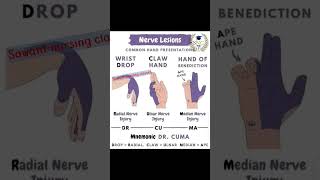 Nerve Lesions tricknursing medical nursingstudent psychiatric treanding trendingshorts nurse [upl. by Anitirhc139]