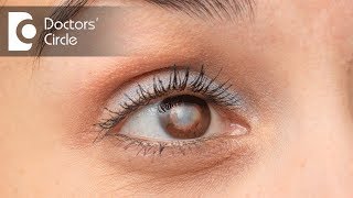 Which is the best Intraocular Lens suited for eyes Dr Samina F Zamindar [upl. by Inattirb]