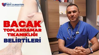 Bacak Toplardamar Tıkanıklığı Belirtileri Nelerdir  PROF DR MERT DUMANTEPE [upl. by Libbi]