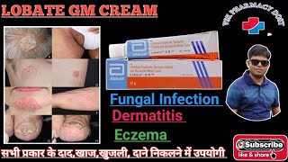 Lobate Gm Cream Useful in Eczema DermatitisItching And Fungal Infection Also [upl. by Atikaj]