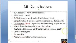 Pathology 425 b Myocardial Infarction complications rupture heart MI post Dressler syndrome [upl. by Ardaed124]