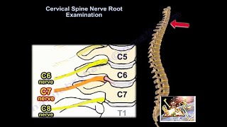 Cervical Spine Nerve Root Examination  Everything You Need To Know  Dr Nabil Ebraheim [upl. by Ewens989]