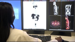 PSMA PET Scan Used For Prostate Cancer – Memorial Cancer Institute [upl. by Robins920]