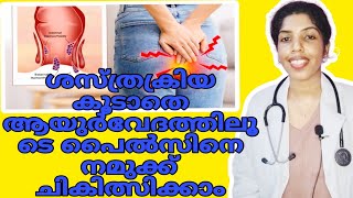 പൈൽസിന് ആയുർവേദ ചികിത്സകൾpilespilestreatment ayurvedadoctormalayalamviralvideo [upl. by Ylremik395]