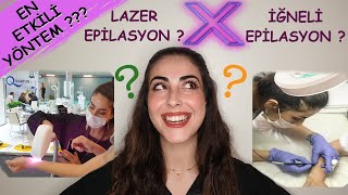 LAZER EPİLASYON vs İĞNELİ EPİLASYON │En Etkili Yöntem Hangisi  Yüze Lazer Yapılır mı [upl. by Oilisab]