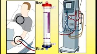 Setting Up of Dialysis Machine [upl. by Atteuqahc912]