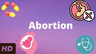 Abortion Everything You Need To Know [upl. by Origra]