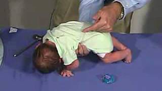 physical exam Newborn Normal Primitive Reflexes  Galant [upl. by Towill23]