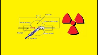 5Rhr XRAYS [upl. by Asaert697]