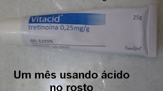 Como estou usando ácido tretinoína  Vitacid 1 [upl. by Chantalle253]