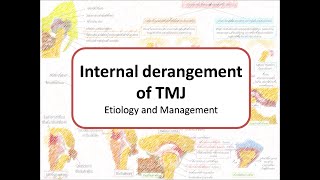 Internal derangement of TMJ Etiology amp Management Arthrocentesis Arthroscopy Condylectomy [upl. by Nannerb]