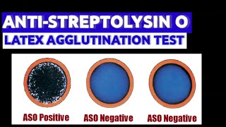 Antistreptolysin O Latex Agglutination Test  MEDICAL LABORATORY SCIENCE [upl. by Cammie23]