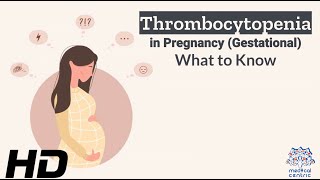 Thrombocytopenia in Pregnancy Risks Symptoms and Treatmen [upl. by Anitac]