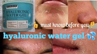 Hyaluronic water gel 💦 25 दिन use करने के बाद genuine reviewsStud muffin [upl. by Phare]