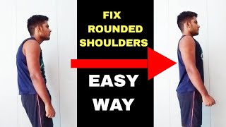 Fix Rounded Shoulders  Correct Posture  Hunch back Fix in Hindi [upl. by Longo]