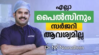 എല്ലാ പൈൽസിനും സർജറി ആവശ്യമില്ല  Piles Treatment Malayalam  Dr Noorudheen [upl. by Ardis]