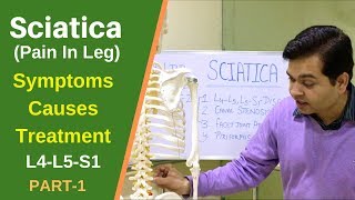 Sciatica Sciatic Nerve PainL4L5S1 Treatment of Sciatica LEG PAINSciatica Pain relief PART1 [upl. by Ardnuassak]