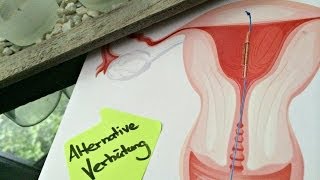 ALTERNATIVE VERHÜTUNGSMETHODE OHNE HORMONE  ERFAHRUNGEN MIT DER PILLE [upl. by Onairda]