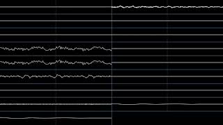 Megalovania  Earthbound Halloween Hack Oscilloscope View [upl. by Danyluk35]