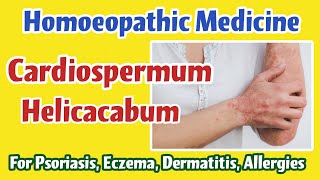 Cardiospermum Helicacabum Homoeopathic Medicine for Psoriasis Eczema Dermatitis Allergies [upl. by Camm504]