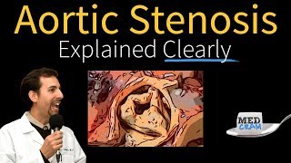 Aortic Stenosis Explained Clearly  Diagnosis and Treatment [upl. by Derril]