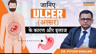 जानिए Ulcer अल्सर क्यों होता है और इलाज क्या है  Duodenal and Gastric Ulcers Treatment [upl. by Nohcim758]